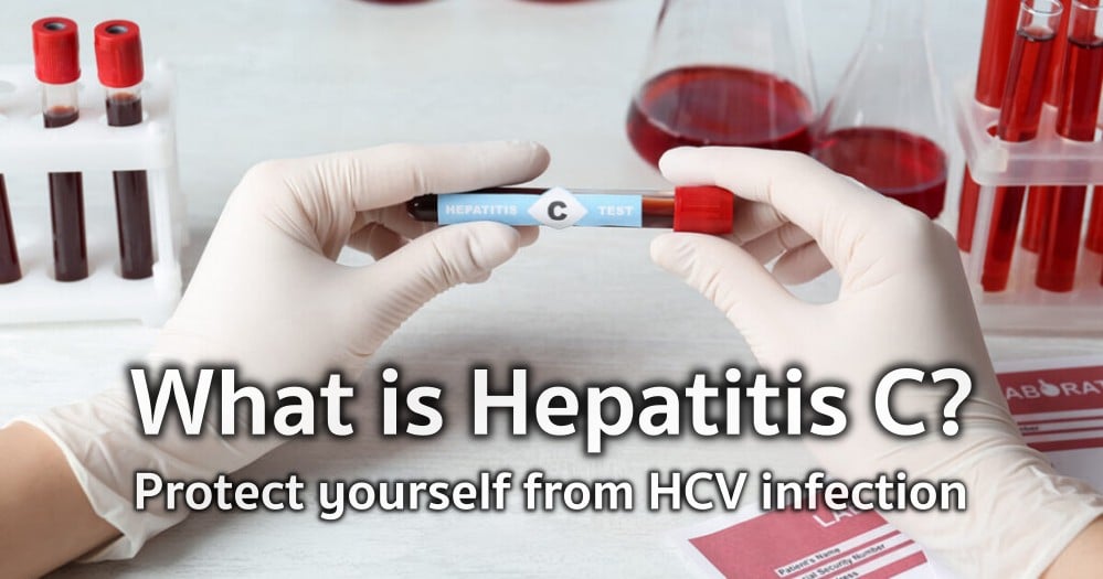 How Dangerous Is Hepatitis C? Understanding the Disease, From Prevention to Treatment
